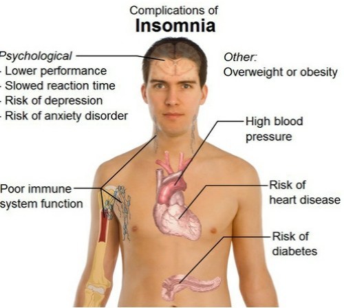 The effects of sleep deprivation